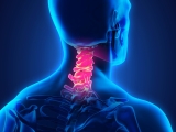 Diện Chẩn chữa thoái hóa đốt sống cổ