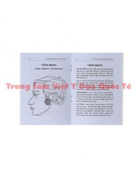 Viêm Họng