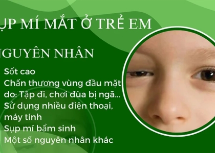 Diện Chẩn Chữa Sụp Mí Mắt