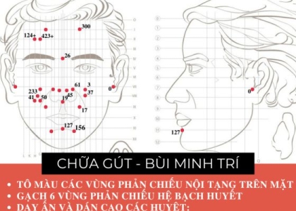 Diện Chẩn Chữa Gout