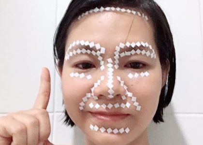 Diện Chẩn Chữa Vẩy Nến