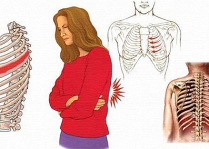 Diện Chẩn chữa đau dây thần kinh liên sườn