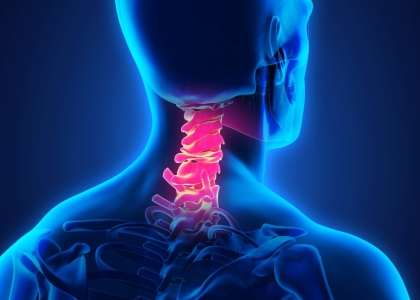 Diện Chẩn chữa thoái hóa đốt sống cổ