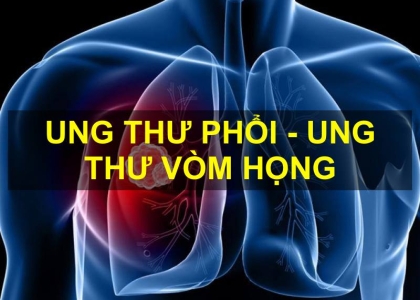 Diện Chẩn Chữa Ung Thư Phổi