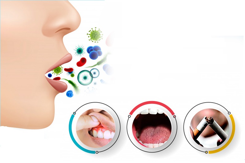 Diện Chẩn chữa bệnh hôi miệng